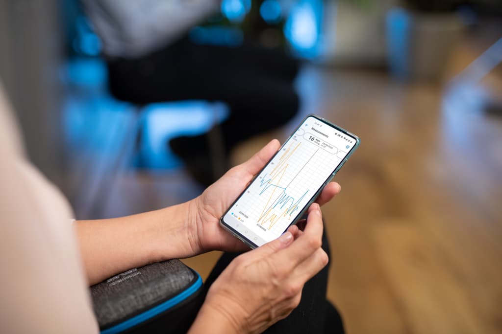 PATIENT2 mobile app showing IOP measurement trends and data